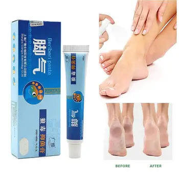 20g Piciorul de Atlet Unguent Anti-Fungice Crema Tratament Picioare Picior Miros urât Mirositoare Beriberi Mâncărime Pecingine Grijă Sudoare Rem X5G3