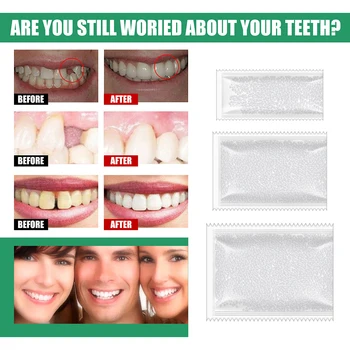10/50/100g Dentare Dinte Temporar Kit de Reparare Îngrijire Orală Dinți Falși Lipici Solid Dinți Remedia Lacunele Adezivă pentru Proteze Instrument de Albire
