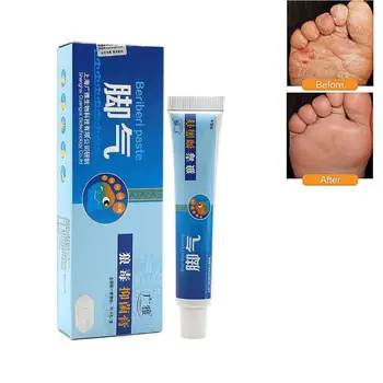 20g Piciorul de Atlet Unguent Anti-Fungice Crema Tratament Picioare Picior Miros urât Mirositoare Beriberi Mâncărime Pecingine Grijă Sudoare Rem X5G3