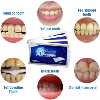 5D Gel de Albire Benzi Albe Dinte Dentare kit de Igienă Orală Îngrijire Benzi pentru Dinți falși Fatetele Dentist seks Albi gel