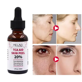 30ml Micsora Porii Fata de Îngrijire a Pielii Ser TCA Acid Ser Facial Hidratant Anti-Rid Faciale de Întinerire a Pielii Înălbitor