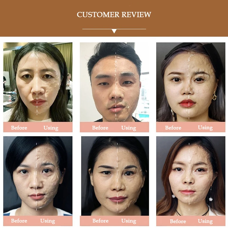 îngrijire asiatică anti-îmbătrânire a pielii)